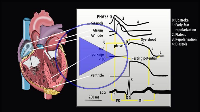 acute-care-physical-therapy-continuing-education-atelectasis