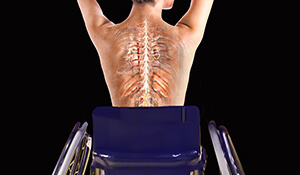 Spinal Cord Rehabilitation - The Next Step
