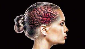 a female with detailed anatomical view of her brain showing the impact of stroke on these anatomical structures
