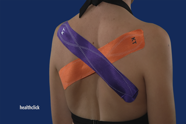 Upper Extremity and Back Techniques  Utilizing Kinesiology Tape

